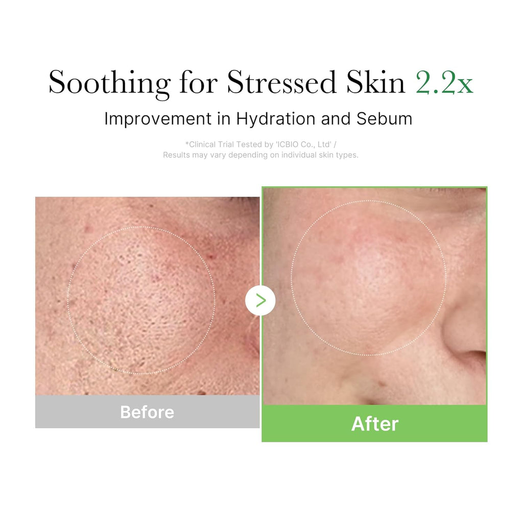Medicube  Exosome Cica Calming Cream