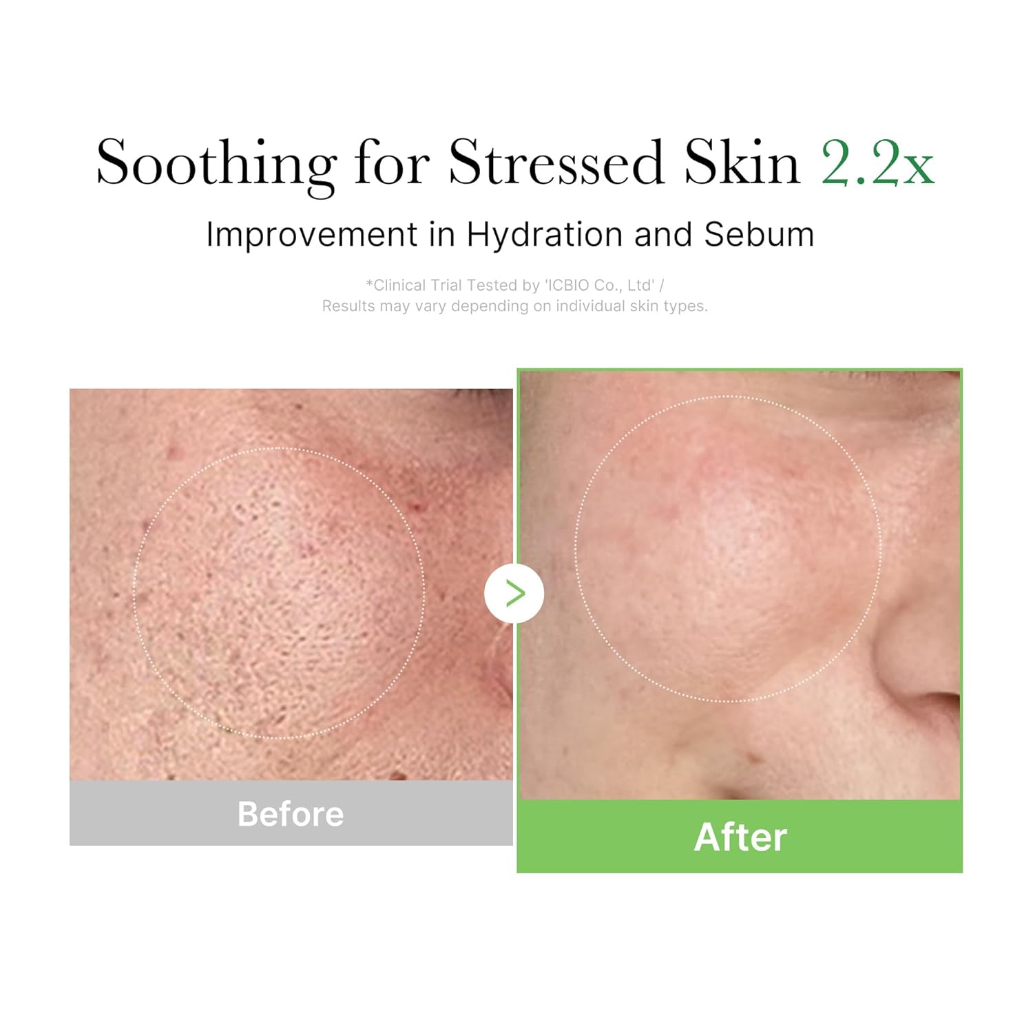 Medicube  Exosome Cica Calming Cream