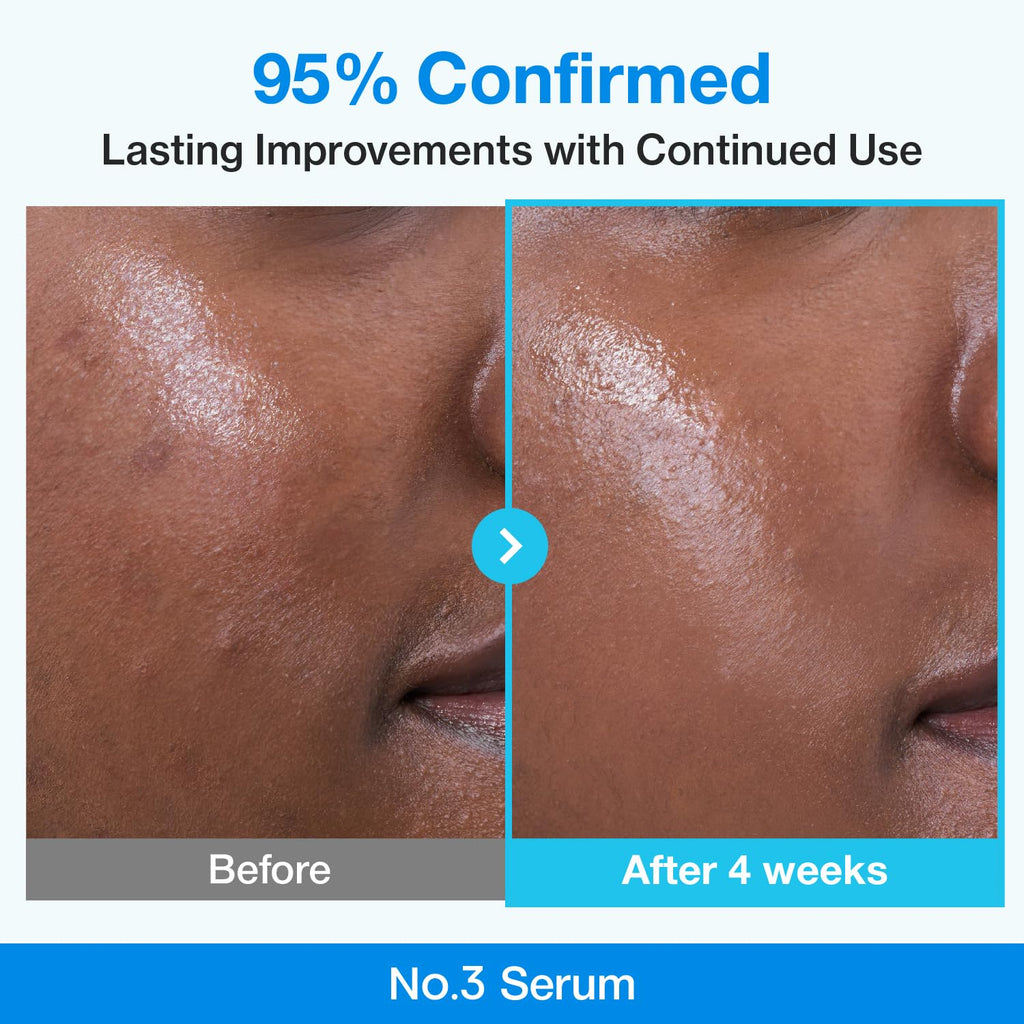 Numbuzin No.3 retinol Serum  Blue Bio-Retinol Pore Refining Serum  Retinol Beginner