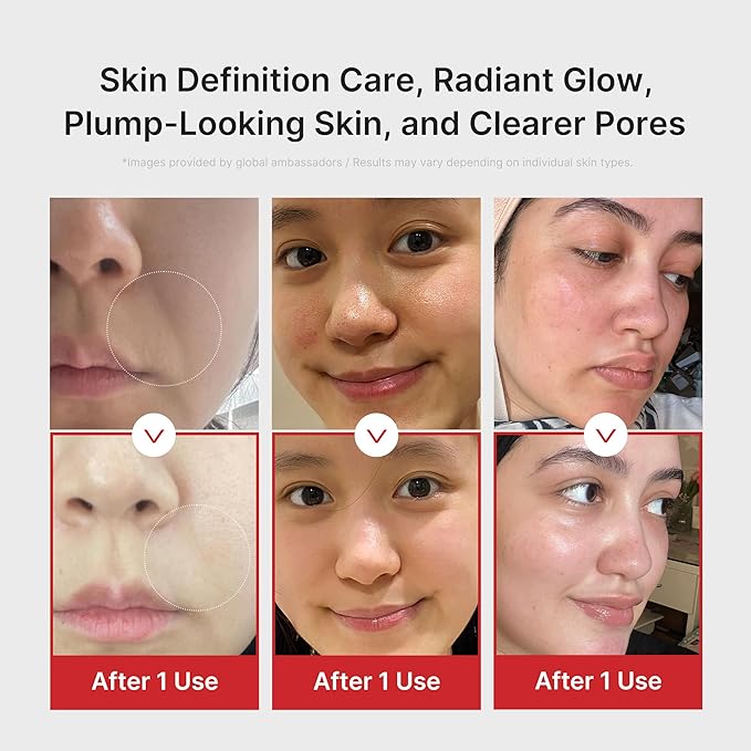Age-R Pdrn Repair Ritual