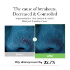 Medicube  Exosome Cica Calming Toner