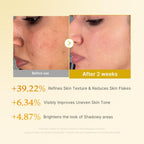 Medicube Kojic Acid Turmeric Resurfacing