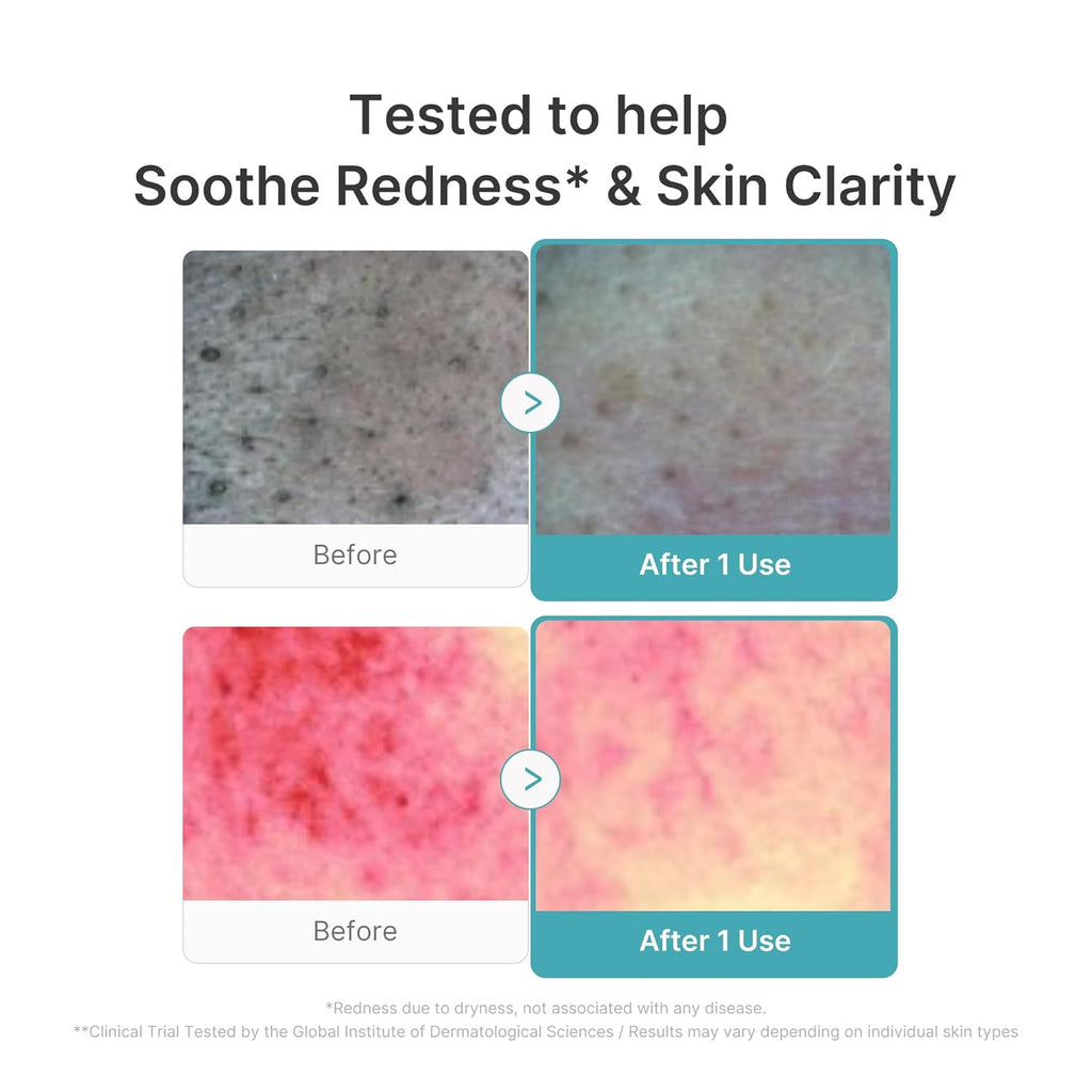 Medicube Facial Cleanser Azelaic Acid Capsule Foam Cleanser