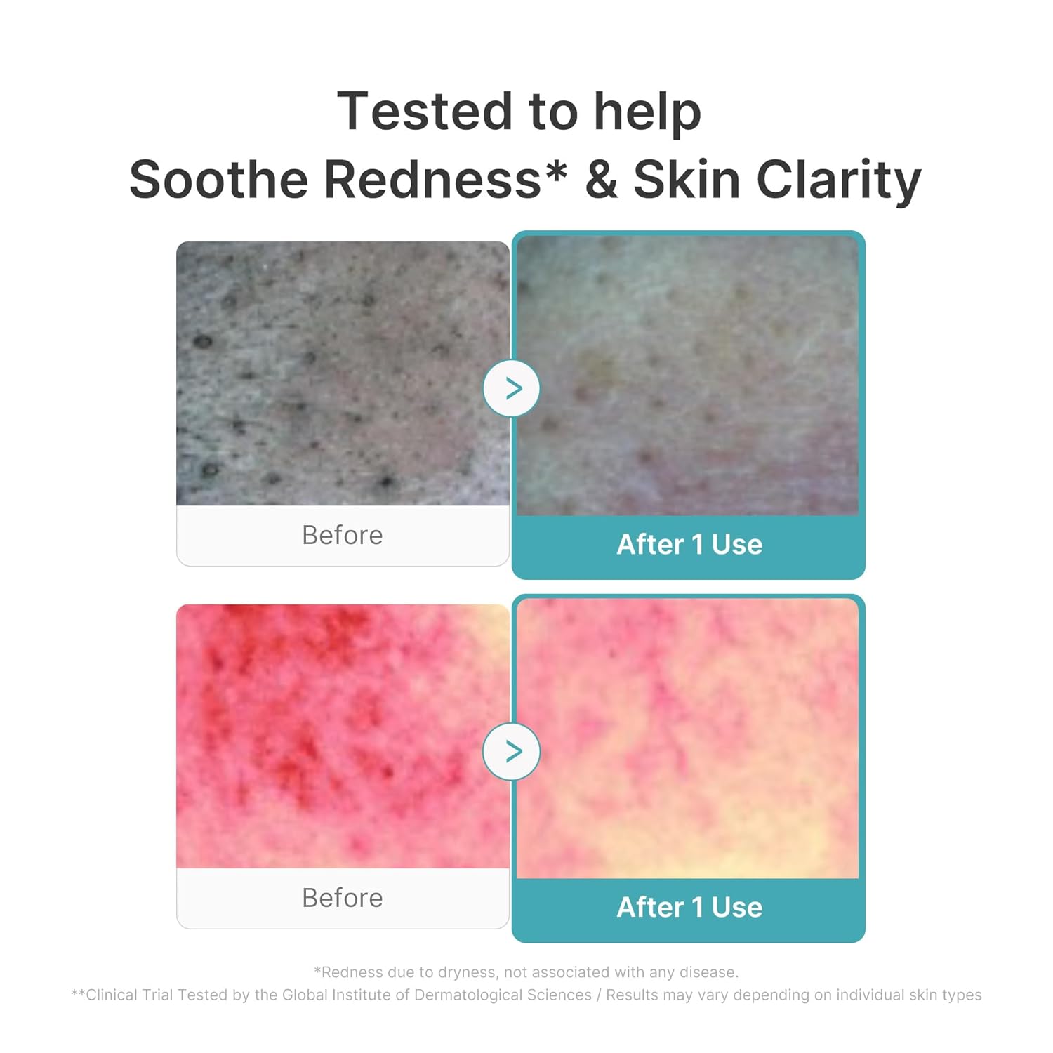 Medicube Facial Cleanser Azelaic Acid Capsule Foam Cleanser