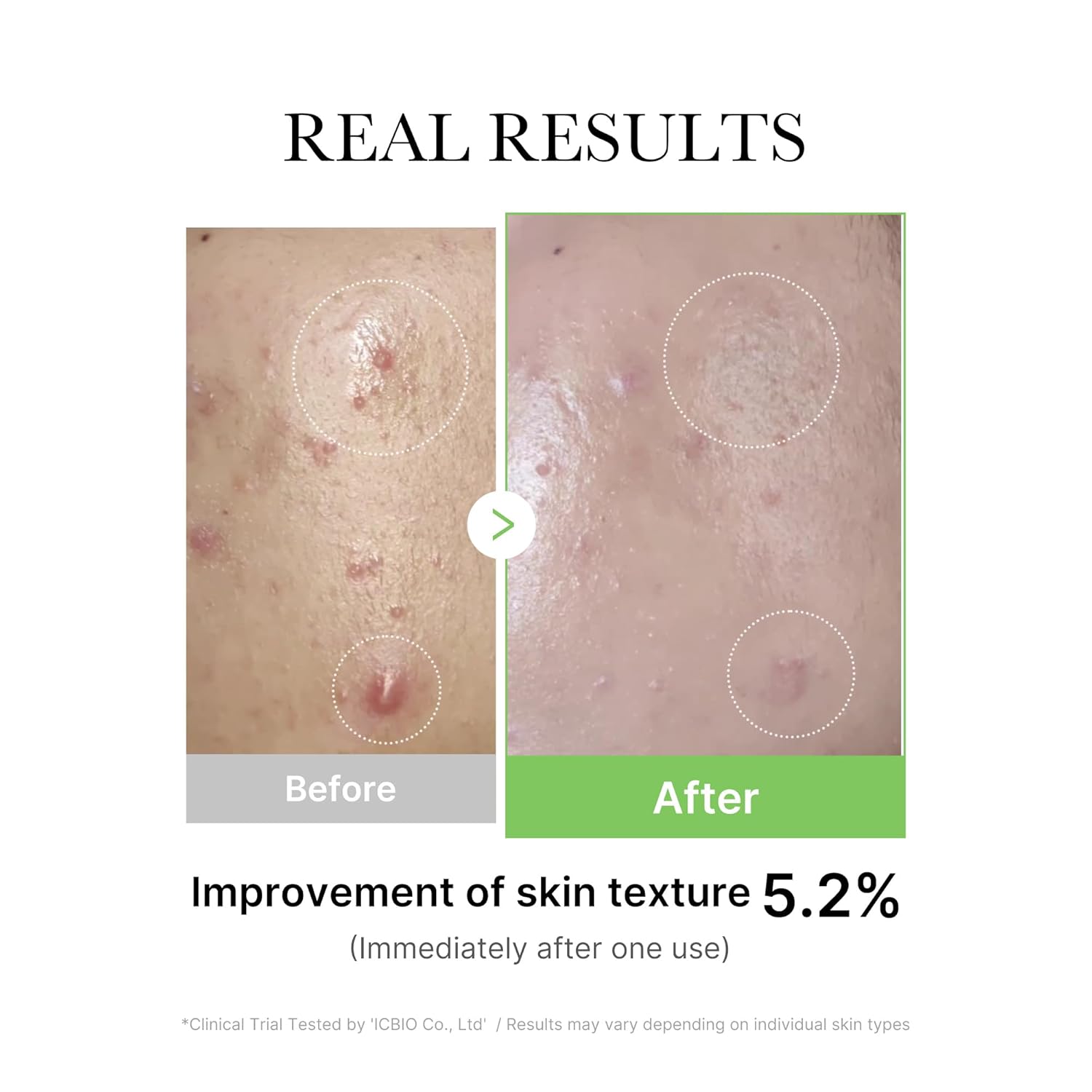 Medicube Exosome Cica Serum