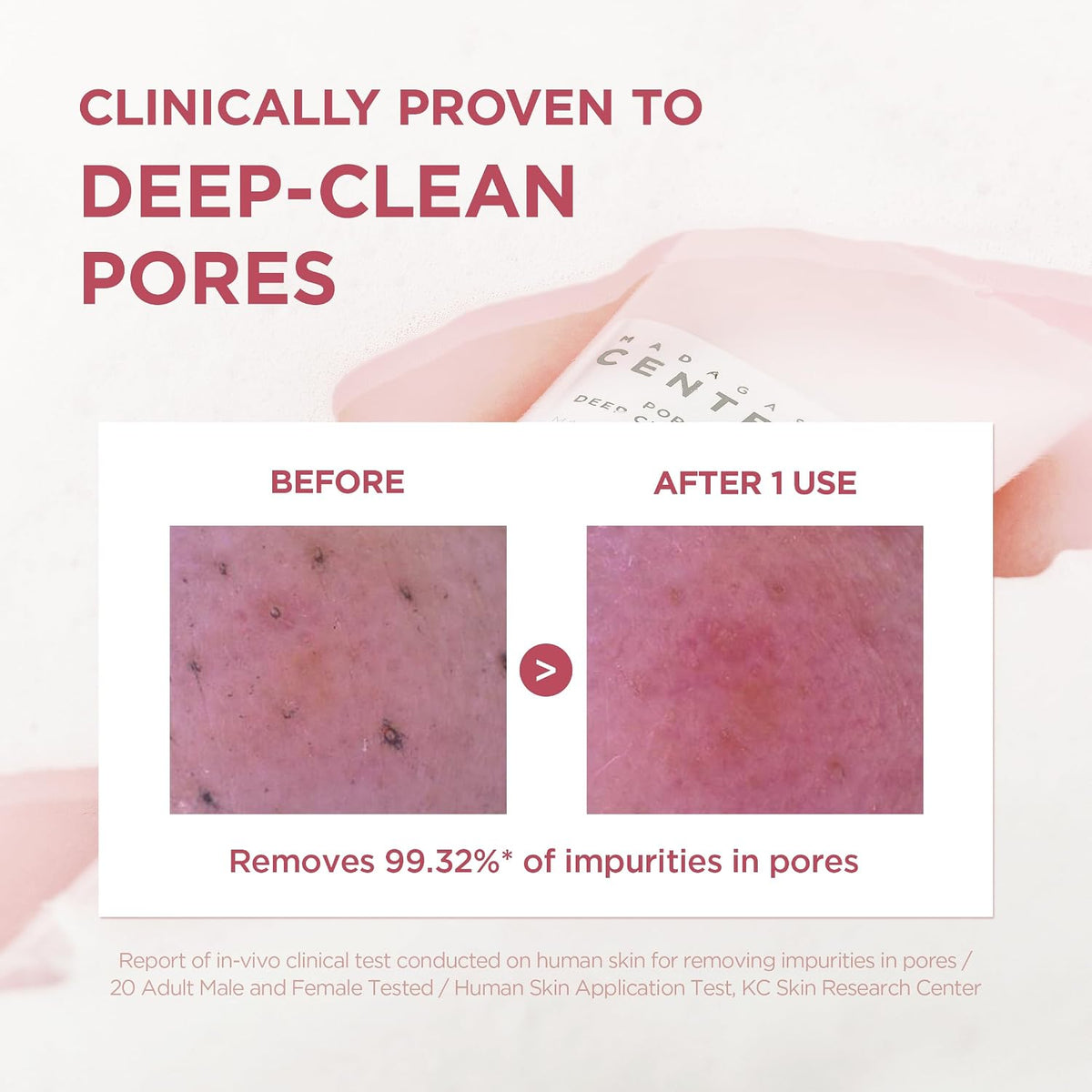 Poremizing Deep Cleansing Foam