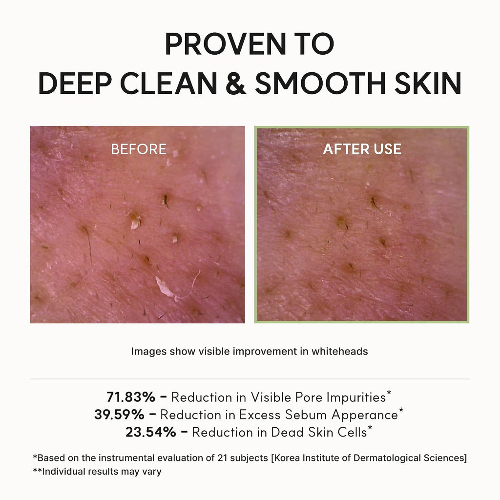 Arencia Rice Mucin Cleanser 120 Gm