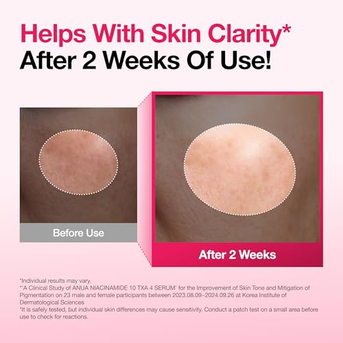 Anua Niacinamide 10% and TXA 4% Dark Spot