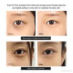Dr.Melaxin Calcium Dark Spot Eye Cream 15g – Niacinamide & Calcium Gluconate Eye Cream