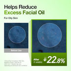 Anua Azelaic Acid 10 Hyaluron Redness Soothing Serum