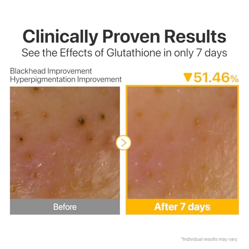 Numbuzin No.5 Cleansing Oil, Glutathione & Vitamin C Cleanser