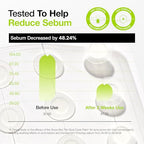 ANUA Ultra-Thin Spot Cover Patch, Invisible Hydrocolloid Pimple Patches for Face,
