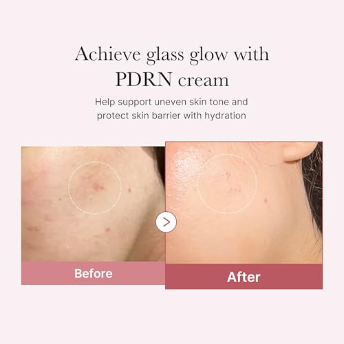 Medicube PDRN Pink Hyaluronic Moisturizing Cream