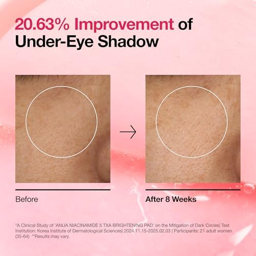 Anua Niacinamide 5 TXA Toner Pads, Daily Facial Pads for Glass Skin