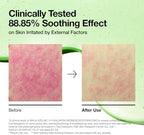ANUA Azelaic Acid 10 Hyaluronic Acid Soothing Toner Pads