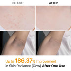 Dr. Melaxin Peel Shot Exfoliating Kojic Acid Turmeric Spray 200ml