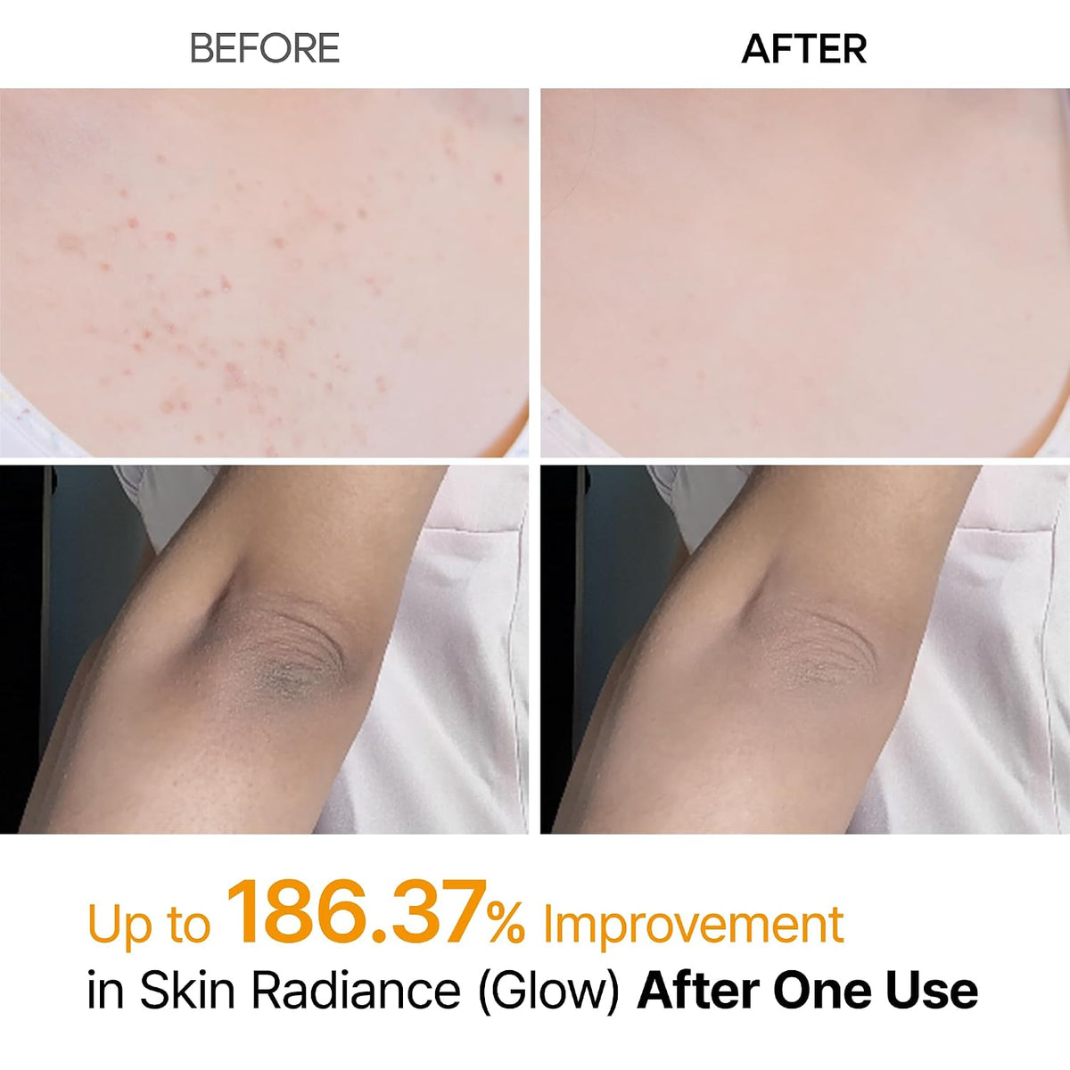 Dr. Melaxin Peel Shot Exfoliating Kojic Acid Turmeric Spray 200ml