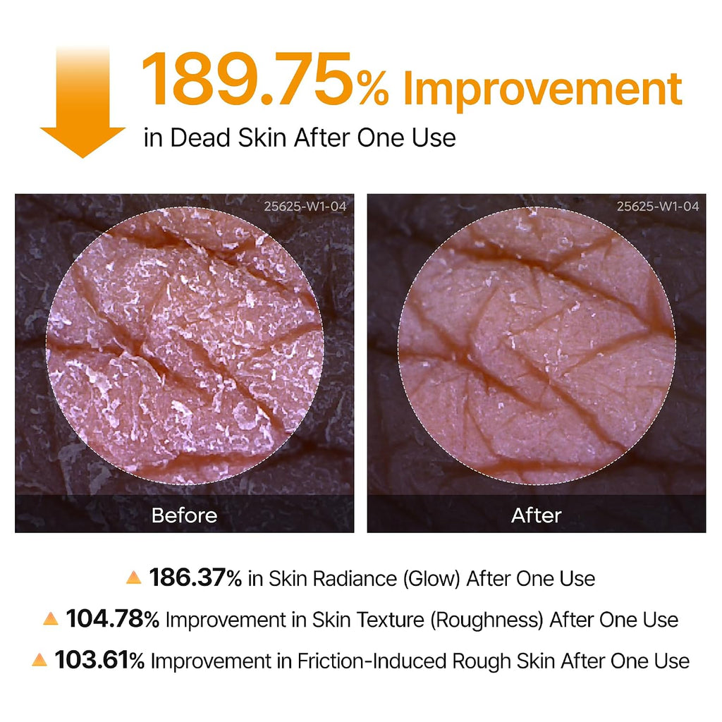 Dr. Melaxin Peel Shot Exfoliating Kojic Acid Turmeric Spray 200ml