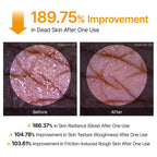 Dr. Melaxin Peel Shot Exfoliating Kojic Acid Turmeric Spray 200ml