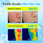 Eqqualberry Hyaltoin Flooding cream