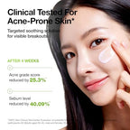 ANUA Azelaic Acid CICA Skin Soothing Moisturizer