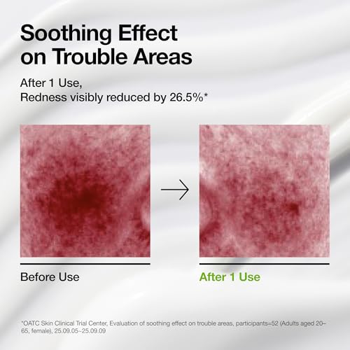 ANUA Azelaic Acid CICA Skin Soothing Moisturizer