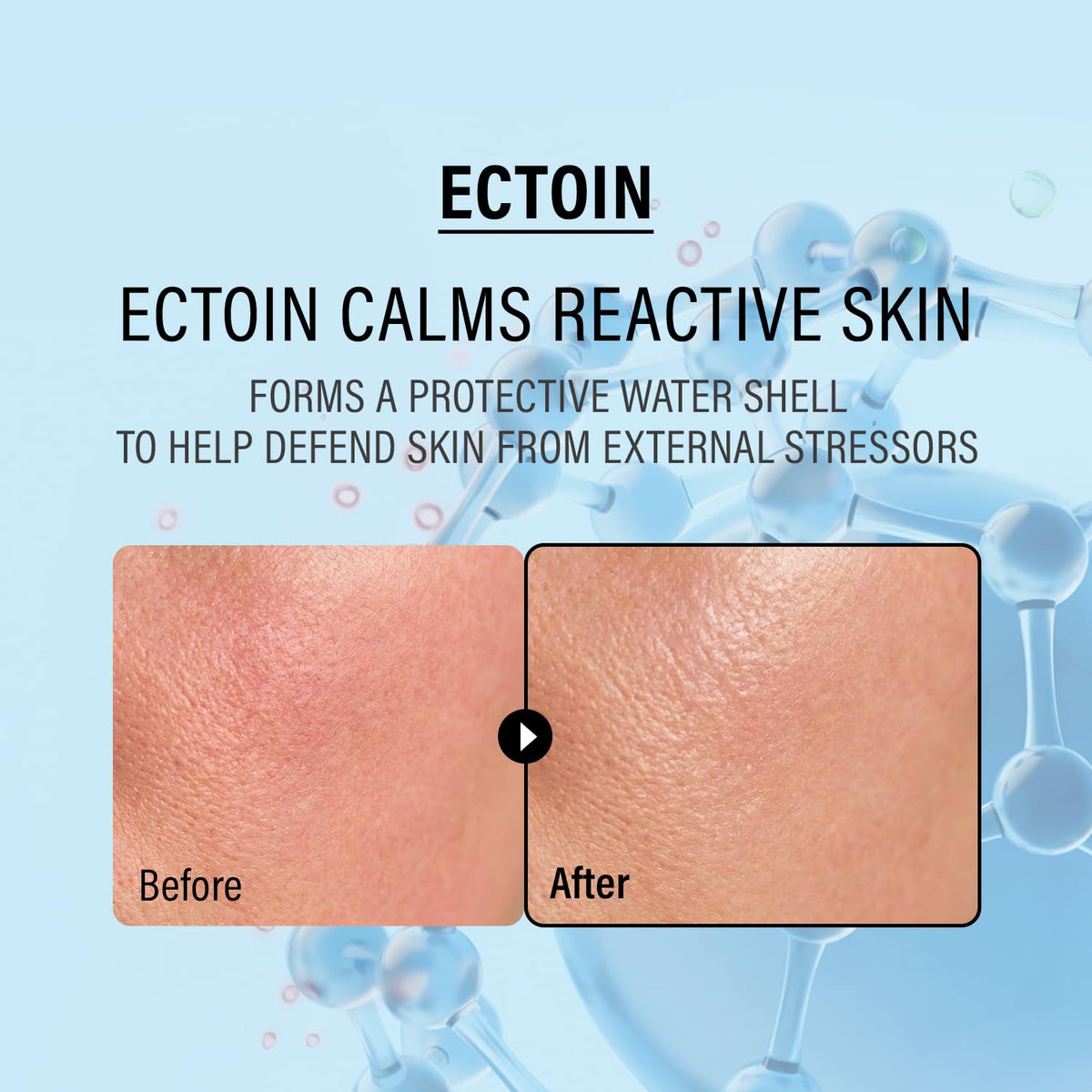 Double Up Cream - Ectoin Face Moisturizer with Panthenol & 15% Squalane