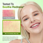 anua  Azelaic Acid 10 Hyaluron Redness Soothing Serum Set Kpop Demon Hunter