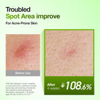 anua  Azelaic Acid 10 Hyaluron Redness Soothing Serum Set Kpop Demon Hunter
